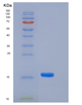 Recombinant Human FABP4 / ALBP / A-FABP Protein (29 Ala/Thr, His tag)