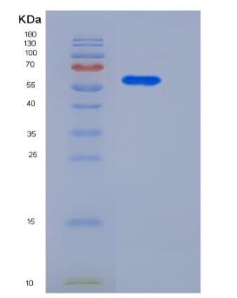 Recombinant Human CD146 / MCAM Protein (His tag)