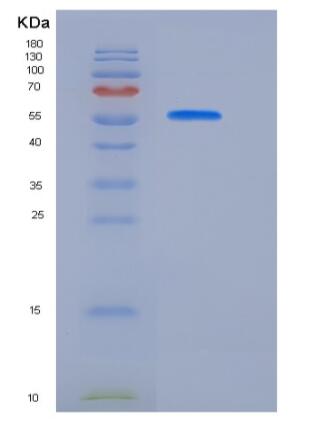 Recombinant Rat BCAM Protein (His tag)