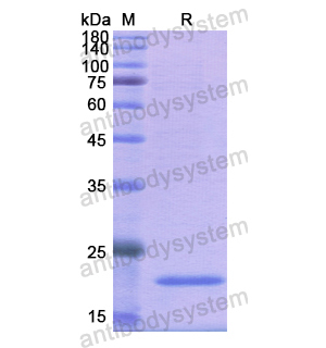 Recombinant Human MYL2, N-His