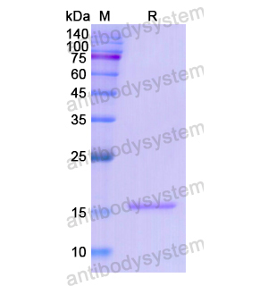 Recombinant Human MAP2, N-His