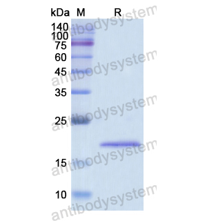 Recombinant Human BCR, N-His