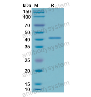 Recombinant Human CD107a/LAMP1, N-His