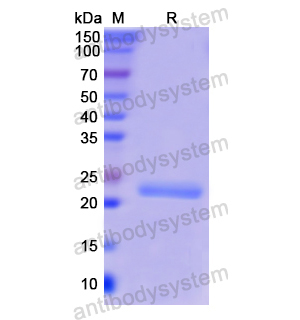 Recombinant Human CD79α/CD79A, N-His