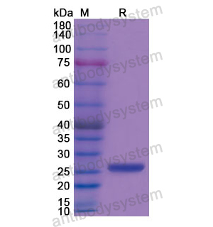 Recombinant Human CKMT1A, N-His