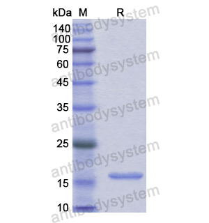 Recombinant Human MYH1, N-His