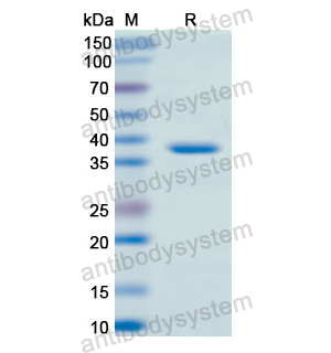 Recombinant Human CD56/NCAM1, N-His