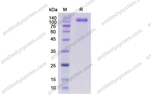 Recombinant Human CD56/NCAM1, C-His