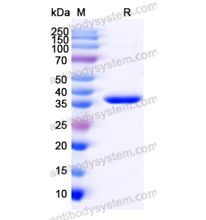 Recombinant Human VCAN, N-His