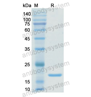 Recombinant Human PDIA4, N-His