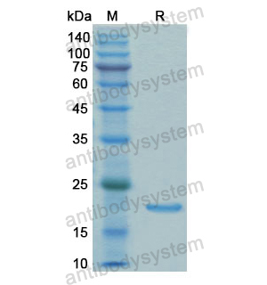 Recombinant Human TPT1, N-His