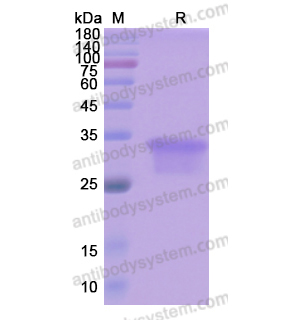 Recombinant Human OSM/Oncostatin-M, C-His