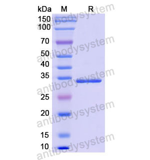 Recombinant Human TNNT1, N-His (YHD01501)