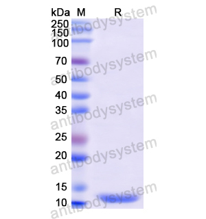 Recombinant Human CCNB1, N-His