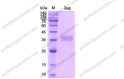 Recombinant Human CD122/IL2RB, C-His