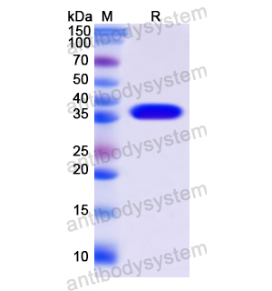 Recombinant Human CPB1, N-His