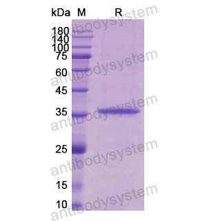 Recombinant Human MYOD1, N-His