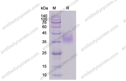 Recombinant Human CD119/IFNGR1, C-His