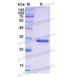 Recombinant Human CD19, N-His