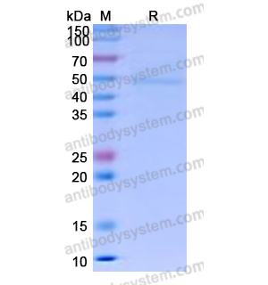 Recombinant Human CD64/FCGR1A Protein, C-His