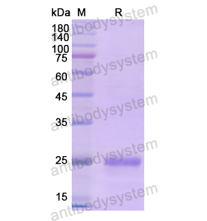 Recombinant Human DSP, N-His