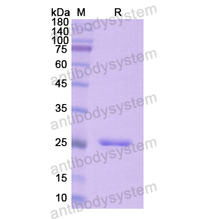 Recombinant Human CD43/SPN, N-His