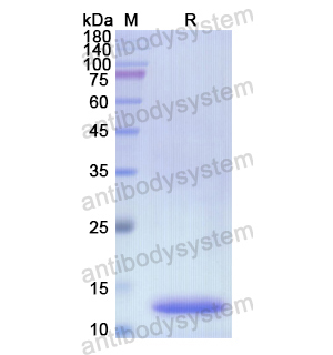 Recombinant Human CD31/PECAM1, N-His