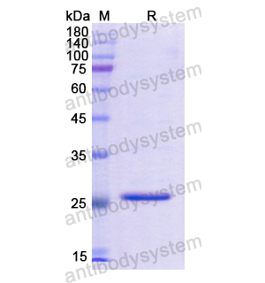 Recombinant Human PRLR, N-His