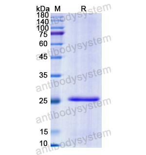 Recombinant Human CRISP2, N-His