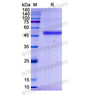 Recombinant Human GOT1, N-His