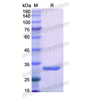 Recombinant Human AKR1C4, N-GST