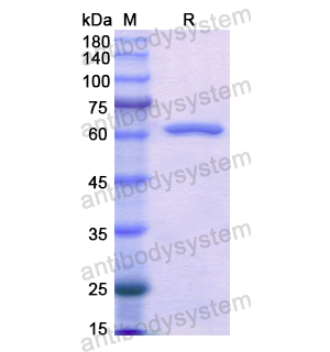 Recombinant Human AKR1C4, N-GST YHD24301