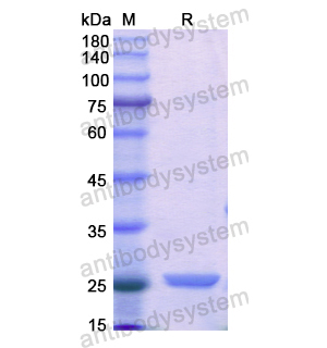 Recombinant Human CTRB1, N-His