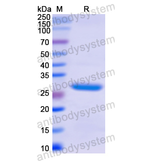 Anti-Human CD64/FCGR1A Antibody (H22) 