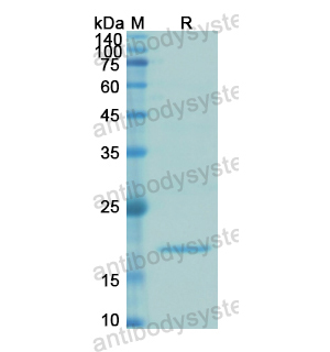 Recombinant Human IGFBP3, N-His