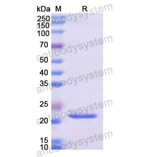 Recombinant Human LIG1, N-His