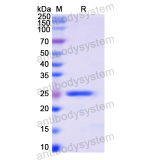 Recombinant Human PLCG1, N-His