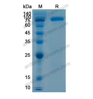 Recombinant Human CD106/VCAM1, N-His