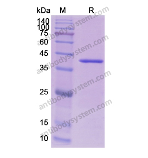 Recombinant Human AOC1/DAO, N-His