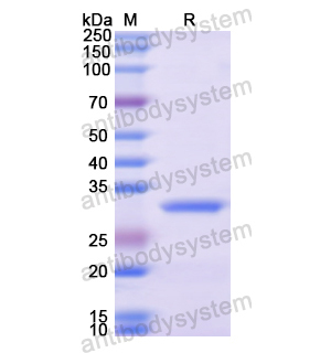 Recombinant Human FST, N-His