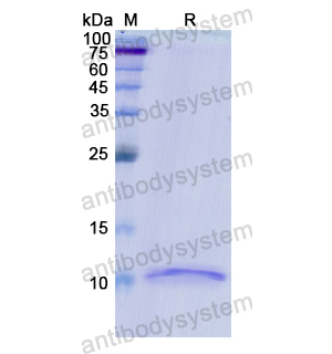 Recombinant Human PI3, N-His