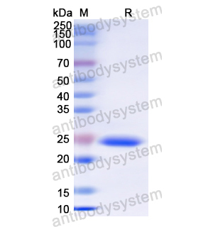 Recombinant Human TYMP/PD-ECGF, N-His