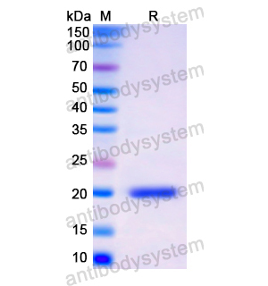 Recombinant Human CD22, N-His