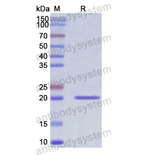 Recombinant Human KITLG/SCF, N-His