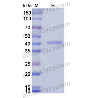 Recombinant Human PROZ, N-GST