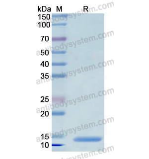 Recombinant Human S100A1, N-His