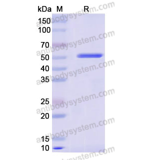 Recombinant Human AHCY, N-His