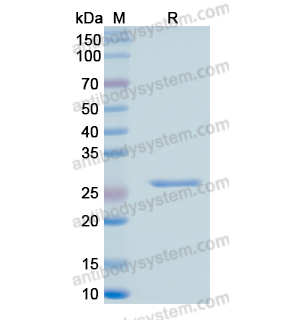 Recombinant Human RRM1, N-His