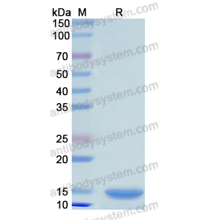 Recombinant Human GPT, N-His