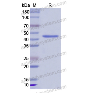 Recombinant Human MMP11, N-His